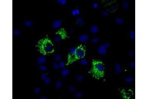 Image no. 2 for anti-Mitochondrial Translational Release Factor 1-Like (MTRF1L) antibody (ABIN1498692)