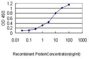 Detection limit for recombinant GST tagged PSPH is approximately 0. (PSPH 抗体  (AA 1-225))