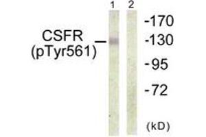 Western blot analysis of extracts from HepG2 cells, using CSFR (Phospho-Tyr561) Antibody. (CSF1R 抗体  (pTyr561))