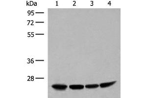 Western blot analysis of Human fetal liver tissue HepG2 K562 and Raji cell lysates using DTYMK Polyclonal Antibody at dilution of 1:400 (DTYMK 抗体)