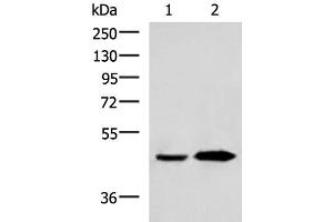 Western blot analysis of Human fetal liver tissue and Human liver tissue lysates using BHMT2 Polyclonal Antibody at dilution of 1:800 (BHMT2 抗体)