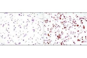 Immunocytochemistry analysis of HCC827 cells, untransfected (left) or transfected with GFP (right) using GFP antibody . (GFP 抗体)