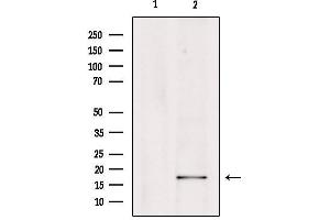 Western blot analysis of extracts from Hepg2, using PGE synthase Antibody. (Prostaglandin E Synthase 抗体  (Internal Region))
