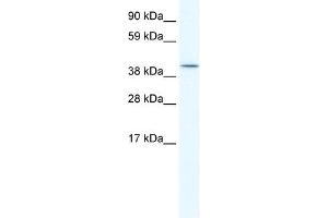 ISL2 antibody (20R-1151) used at 0. (ISL2 抗体  (C-Term))