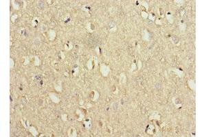 Immunohistochemistry of paraffin-embedded human brain tissue using ABIN7175774 at dilution of 1:100 (WDR6 抗体  (AA 1-200))