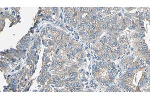 Immunohistochemistry (IHC) image for anti-Cytochrome P450, Family 2, Subfamily E, Polypeptide 1 (CYP2E1) (Internal Region) antibody (ABIN6261170)