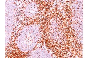 Formalin-fixed, paraffin-embedded human Tonsil stained with CD6 Mouse Monoclonal Antibody (C6/372). (CD6 抗体)
