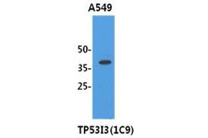 Image no. 1 for anti-Tumor Protein P53 Inducible Protein 3 (TP53I3) antibody (ABIN1490748) (TP53I3 抗体)