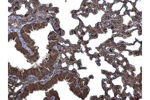 IHC-P Image CLIC3 antibody [N1C3] detects CLIC3 protein at membrane and cytoplasm on mouse lung by immunohistochemical analysis. (CLIC3 抗体)