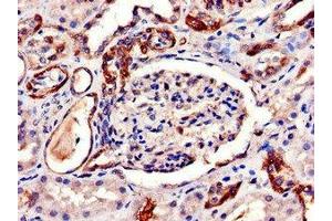 Immunohistochemistry of paraffin-embedded human kidney tissue using ABIN7144520 at dilution of 1:100 (AQP6 抗体  (AA 1-30))