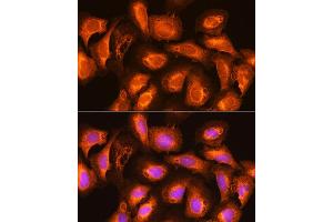 Immunofluorescence analysis of U2OS cells using SEC11A Rabbit pAb (ABIN6133117, ABIN6147478, ABIN6147479 and ABIN6214843) at dilution of 1:100. (SEC11A 抗体  (AA 37-145))