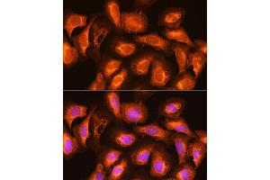 Immunofluorescence analysis of U2OS cells using SEC11A Rabbit pAb (ABIN6133117, ABIN6147478, ABIN6147479 and ABIN6214843) at dilution of 1:100. (SEC11A 抗体  (AA 37-145))