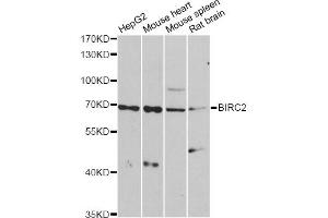 Western blot analysis of extracts of various cell lines, using BIRC2 antibody (ABIN6292780) at 1:1000 dilution. (BIRC2 抗体)