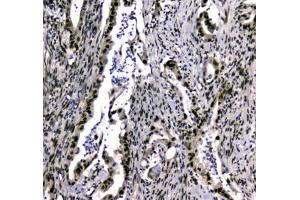 IHC testing of FFPE rat testis tissue with UBA2 antibody at 1ug/ml. (UBA2 抗体)