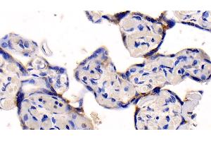 Immunohistochemistry (IHC) image for anti-Nuclear Factor kappa B (NFkB) (AA 352-439) antibody (ABIN7434143)