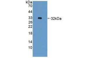 Western blot analysis of recombinant Human ADAM33. (ADAM33 抗体  (AA 210-503))