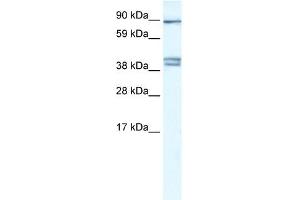 WB Suggested Anti-CLCNKB Antibody Titration:  0. (CLCNKB 抗体  (C-Term))