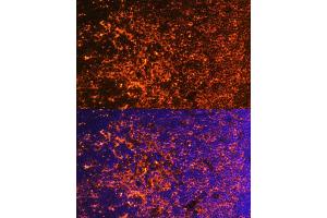 Immunofluorescence analysis of mouse thymus using ICOS/CD278 antibody (ABIN3022590, ABIN3022591, ABIN3022592, ABIN1513055 and ABIN6218929) at dilution of 1:100. (ICOS 抗体  (AA 21-140))
