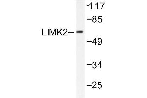Image no. 1 for anti-LIM Domain Kinase 2 (LIMK2) antibody (ABIN265509) (LIMK2 抗体)