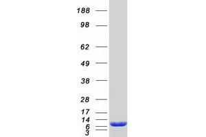 Western Blotting (WB) image for S100 Calcium Binding Protein P (S100P) protein (Myc-DYKDDDDK Tag) (ABIN2731340)