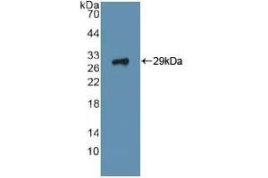 Detection of Recombinant ITGa2, Human using Polyclonal Antibody to Integrin Alpha 2 (ITGa2) (ITGA2 抗体  (AA 170-361))
