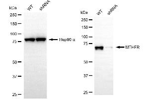 Western blotting analysis using MTHFR antibody (ABIN7799391). (Recombinant MTHFR 抗体)