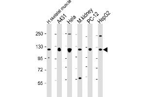 All lanes : Anti-Vinculin at 1:2000 dilution Lane 1: human skeletal muscle lysate Lane 2: A431 whole cell lysate Lane 3: Hela whole cell lysate Lane 4: mouse kidney lysate Lane 5: PC-12 whole cell lysate Lane 6: HepG2 whole cell lysate Lysates/proteins at 20 μg per lane. (Vinculin 抗体  (AA 903-937))