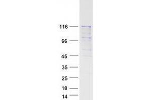 Validation with Western Blot (PLA2G4B Protein (Transcript Variant 1) (Myc-DYKDDDDK Tag))