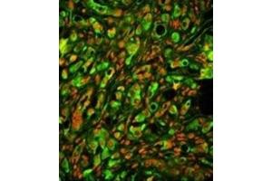 Immunofluorescence (IF) image for anti-Protein tyrosine Phosphatase Type IVA, Member 2 (PTP4A2) antibody (ABIN3002826)
