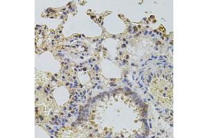 Immunohistochemistry of paraffin-embedded rat lung using PLK4 antibody. (PLK4 抗体)