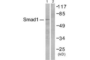 Western Blotting (WB) image for anti-SMAD, Mothers Against DPP Homolog 1 (SMAD1) (Ser465) antibody (ABIN1847896) (SMAD1 抗体  (Ser465))