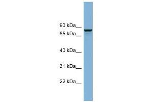 Western Blotting (WB) image for anti-Golgi-Associated, gamma Adaptin Ear Containing, ARF Binding Protein 3 (GGA3) (N-Term) antibody (ABIN631698)