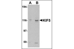 Western blot analysis of KIF5 in K562 cell lysate with this product at (A) 0.