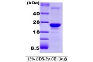 Figure annotation denotes ug of protein loaded and % gel used. (Glyoxalase Protein (AA 1-184))