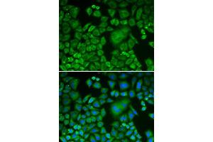 Immunofluorescence (IF) image for anti-ARP3 Actin-Related Protein 3 (ACTR3) (AA 1-418) antibody (ABIN3021339) (ACTR3 抗体  (AA 1-418))