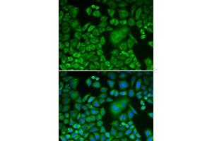 Immunofluorescence (IF) image for anti-ARP3 Actin-Related Protein 3 (ACTR3) (AA 1-418) antibody (ABIN6214919) (ACTR3 抗体  (AA 1-418))