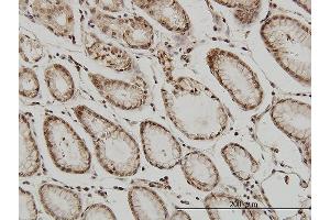 Immunoperoxidase of monoclonal antibody to ATF2 on formalin-fixed paraffin-embedded human stomach. (ATF2 抗体  (AA 1-209))
