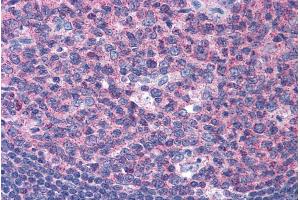 ABIN184967 (3. (SNX16 抗体  (N-Term))