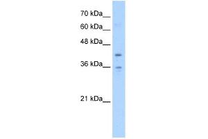 WB Suggested Anti-TMEM104 Antibody Titration:  5. (TMEM104 抗体  (Middle Region))