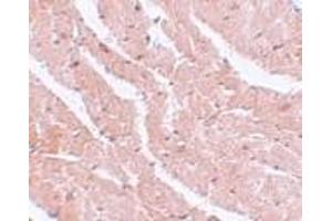 Immunohistochemistry of CAZIP in mouse heart tissue with CAZIP antibody at 5 μg/ml. (CAZIP 抗体  (C-Term))