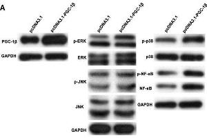 Peroxisome proliferator-activated receptor-gamma coactivator-1 β (PGC-1β) overexpression enhances proinflammatory cytokines, matrix metalloproteinases (MMPs) and receptor activator of nuclear factor-kappa B ligand (RANKL) production in rheumatoid arthritis (RA)-fibrolast-like synoviocytes (FLS). (PPARGC1B 抗体  (AA 901-1023))