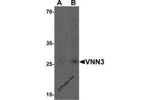 Western Blotting (WB) image for anti-Vanin 3 (VNN3) (C-Term) antibody (ABIN1077383) (VNN3 抗体  (C-Term))