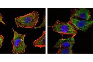 Immunofluorescence analysis of U251 (left) and NTERA2 (right) cells using CRTC1 mAb (green). (CRTC1 抗体)
