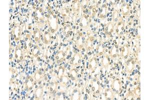 ABIN6263551 and ABIN6266920 at 1/100 staining Rat kidney tissue by IHC-P.