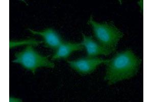 ICC/IF analysis of EEF1A1 in A549 cells line, stained with DAPI (Blue) for nucleus staining and monoclonal anti-human EEF1A1 antibody (1:100) with goat anti-mouse IgG-Alexa fluor 488 conjugate (Green). (eEF1A1 抗体)