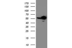 Western Blotting (WB) image for anti-Retinoblastoma Binding Protein 7 (RBBP7) antibody (ABIN1500624) (RBBP7 抗体)