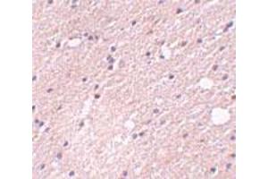 Immunohistochemical staining of human brain tissue with 5 ug/mL FRMPD4 polyclonal antibody .