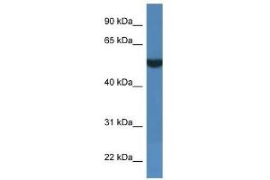 Western Blot showing FSD1L antibody used at a concentration of 1 ug/ml against THP-1 Cell Lysate (FSD1L 抗体  (C-Term))