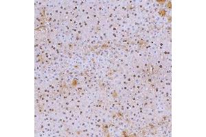 IHC analysis of SNRNP40 using anti-SNRNP40 antibody (ABIN7601719). (SNRNP40 抗体  (AA 43-357))