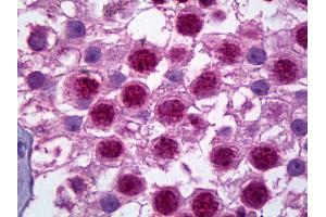 Anti-HES1 antibody IHC of human testis. (HES1 抗体  (N-Term))